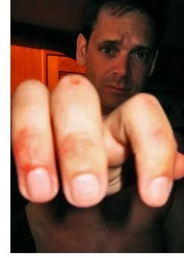 10-day-atlantic-sailing-excursion-part-3-scraped-knuckles.jpg