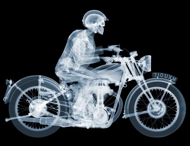 x ray photo of a man on a motorcycle